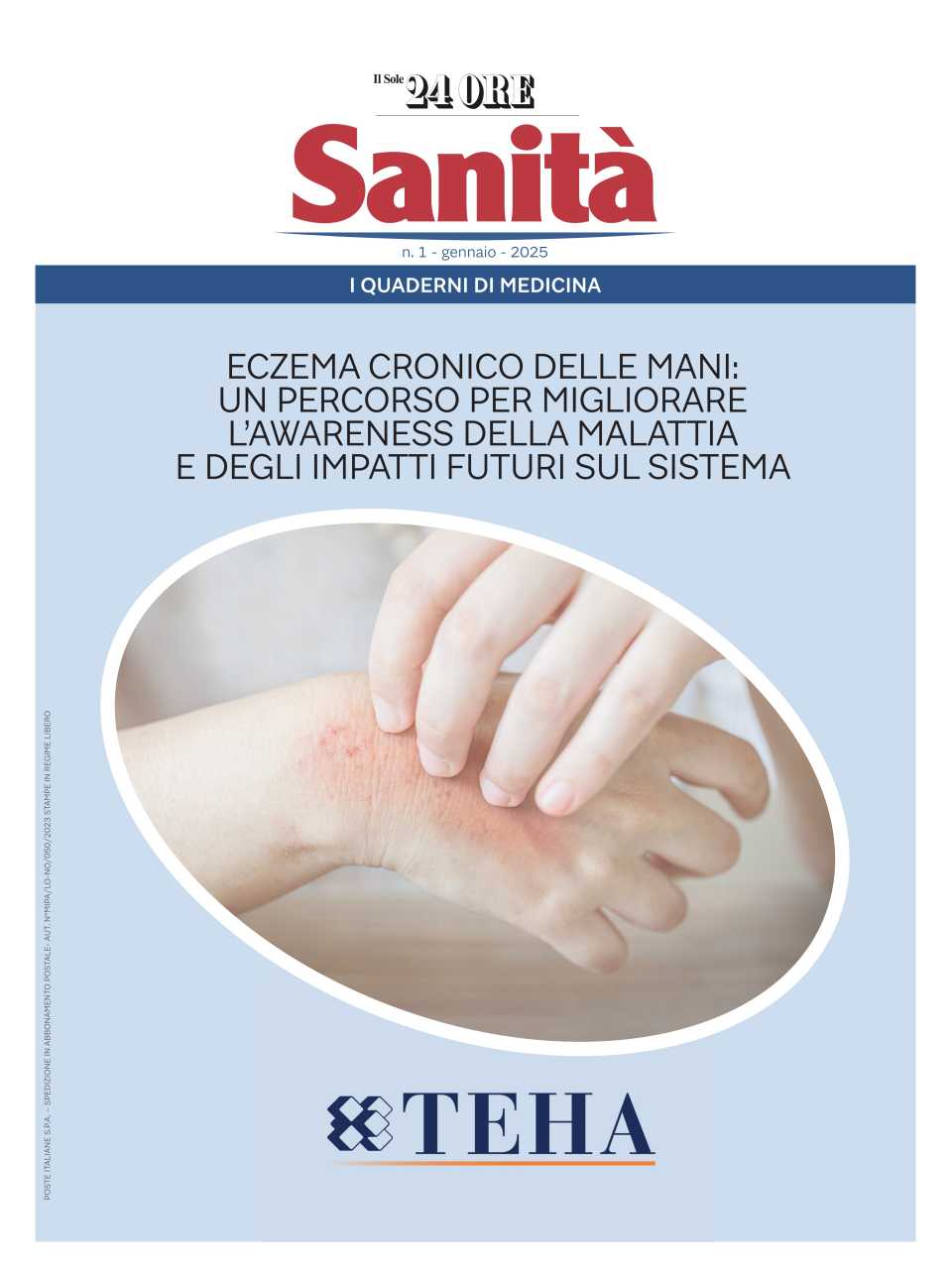 Eczema Cronico delle Mani: un percorso per migliorare l'awareness della malattia e degli impatti futuri sul sistema